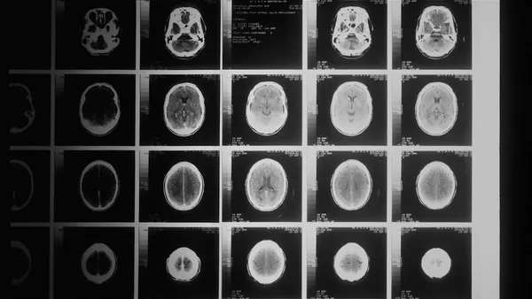 a black and white photo of various mri images