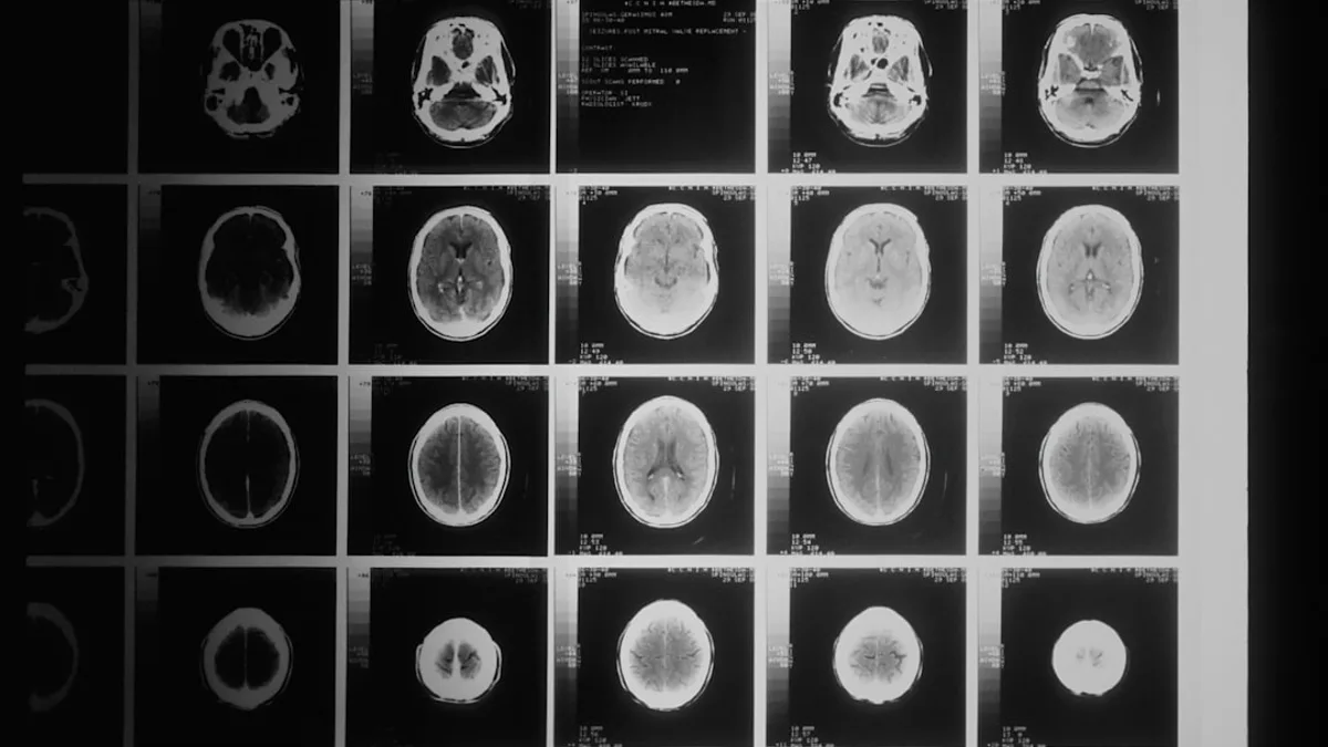 a black and white photo of various mri images